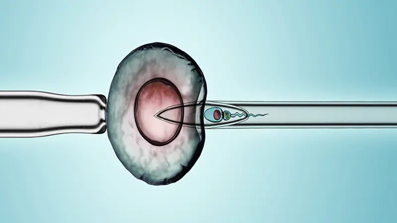 Embryo Freezing and Storage