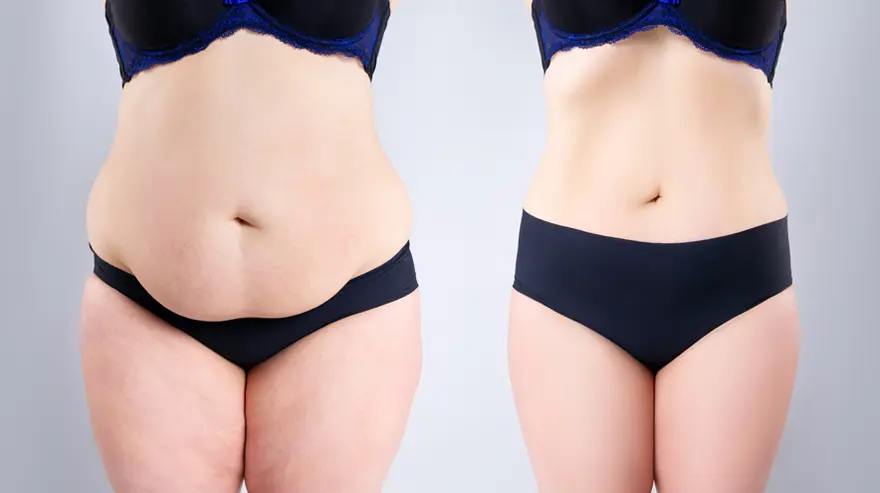 Weight Loss