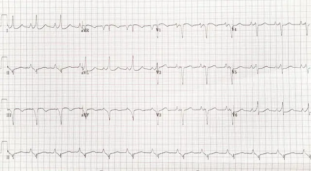 Christian Wolff (philosopher) visual data 6