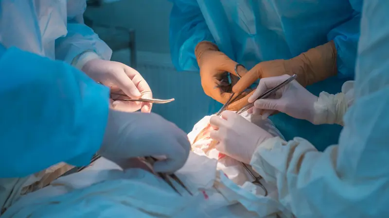 PSARP Surgery for Anorectal Malformations