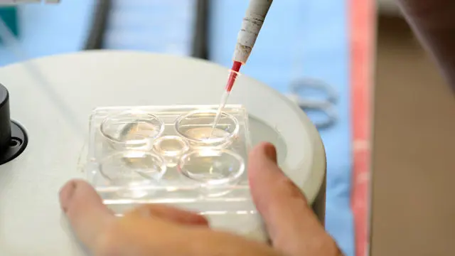 Embryo Transfer Procedure