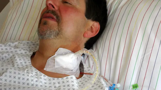 Стентирование сонной артерии