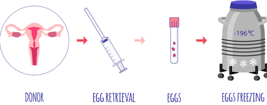Egg Freezing for Fertility Preservation