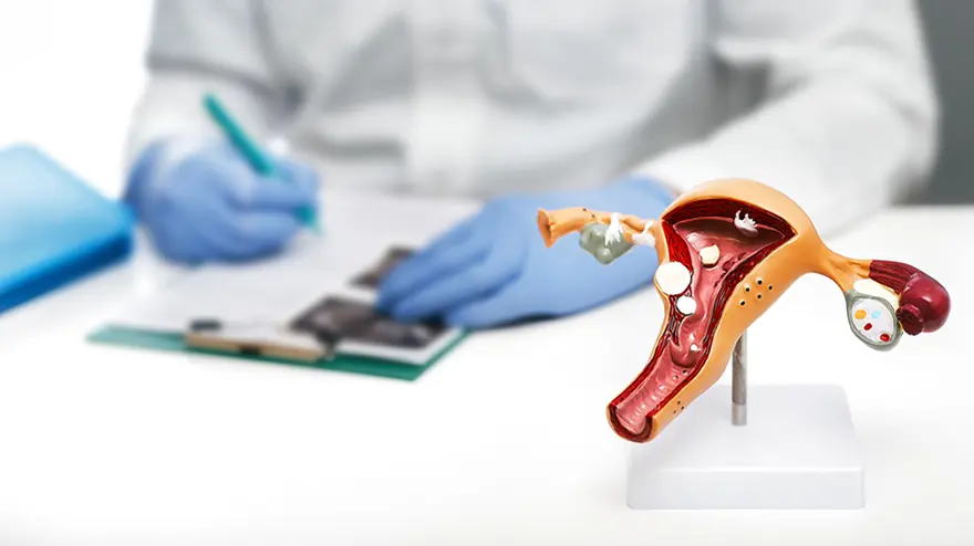 Anatomical uterus model used during consultation for uterine condition care