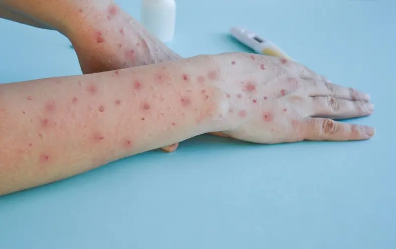 What Everyone Must Know About Fever!