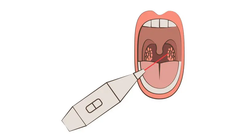 Tonsil Removal Surgery