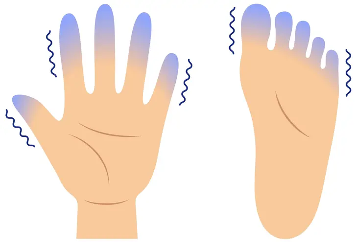 numbness of hands and feet meaning