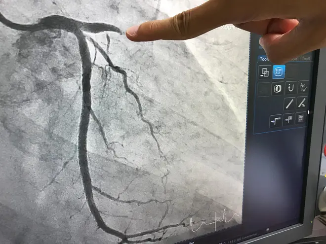 MDCT (Advanced CT Scan Technology)