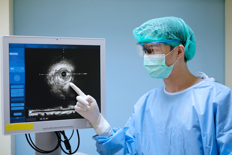 IVUS (Intravascular Ultrasound) Imaging