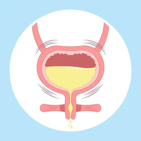 Anuria: A Complete Guide to Causes, Symptoms, and Treatment Options