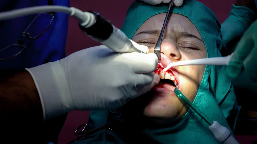 Dental Surgery 
