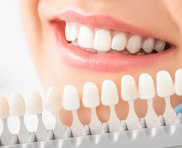 Dental implant korea