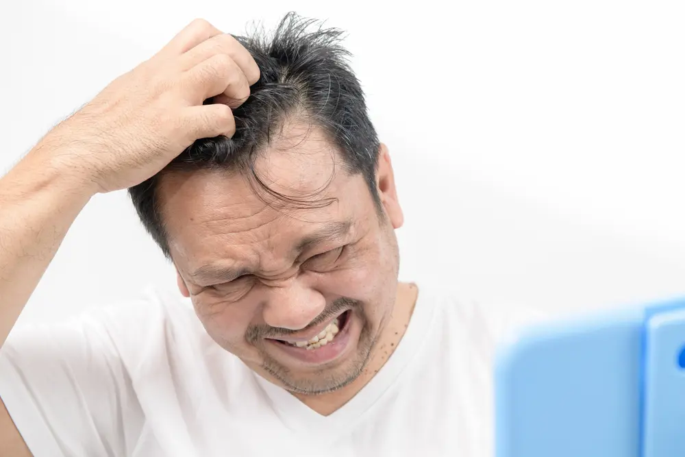 Anti-Dandruff Treatment