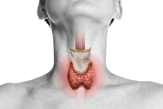 Laryngotomy Procedure