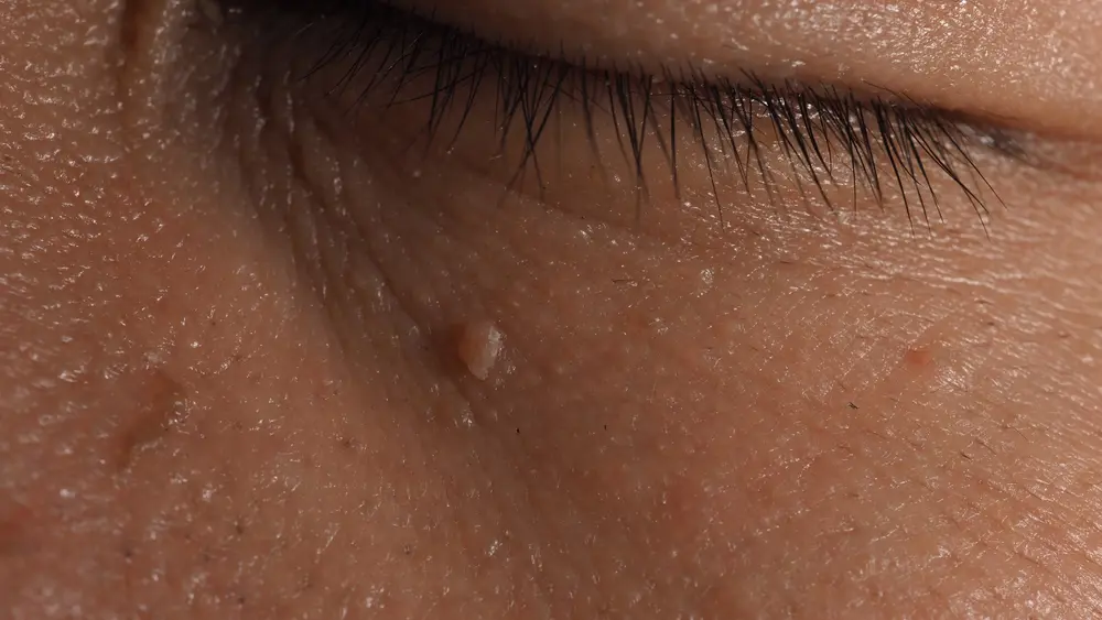 Medical Dermatology
