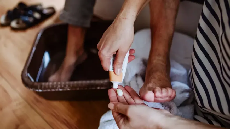 Treatment Options for Nail Disorders