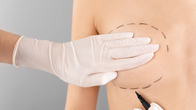 Doctor marking the patient’s chest before breast augmentation surgery.
