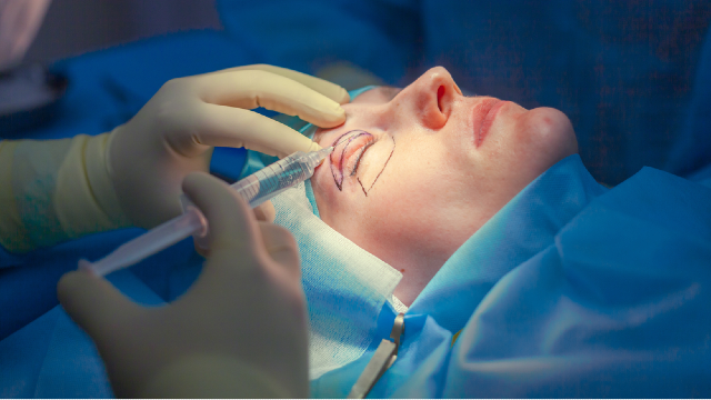 Eye plastic surgery in Korea: local anesthetic is injected near the marked eyelid at the start of the procedure