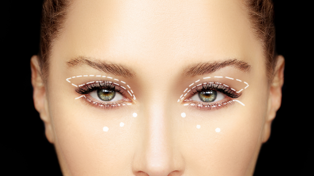 Patient with under-eye markings for fat correction treatment