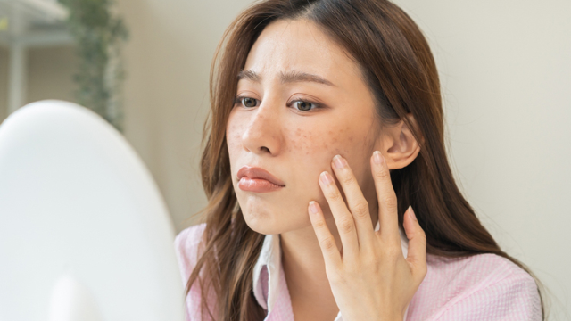 Pores Treatment.