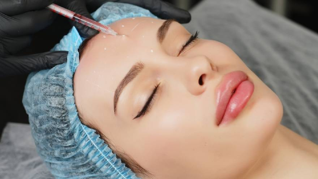 Forehead Botox Treatment.