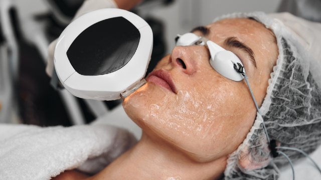Laser Pigmentation Treatment.