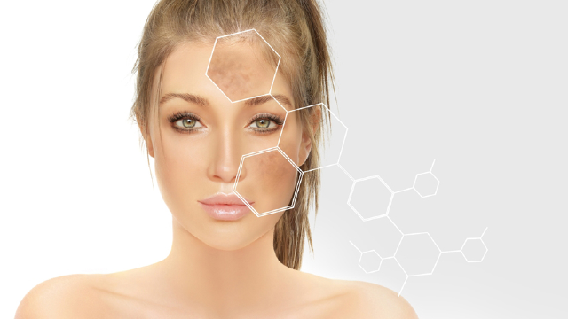 Pigmentation Treatment.