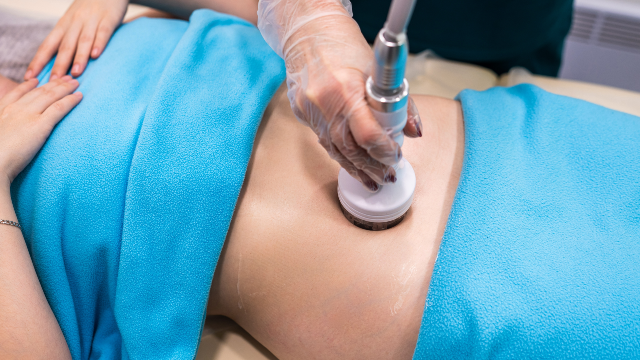 Patient receiving Renuvion skin tightening treatment on the stomach.