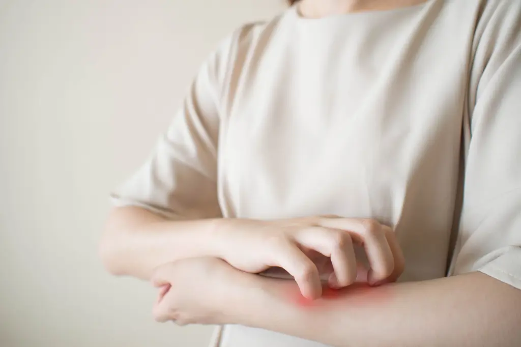 Skin Infections