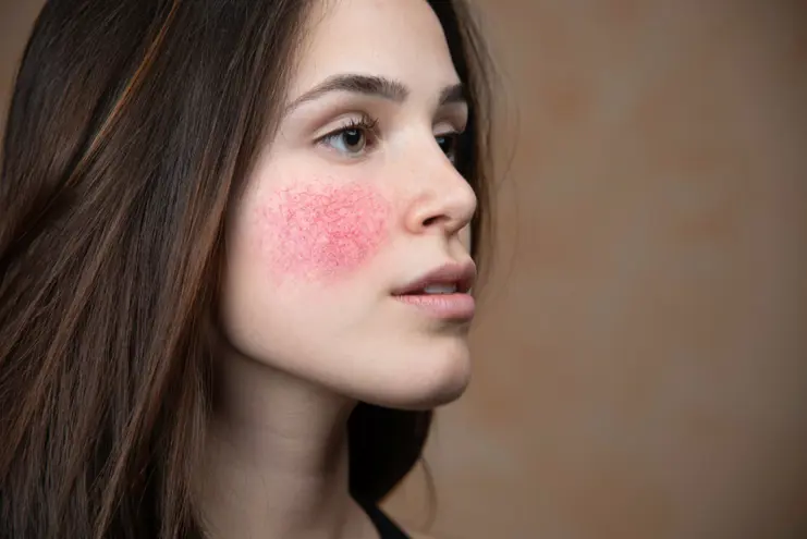 Skin Treatments