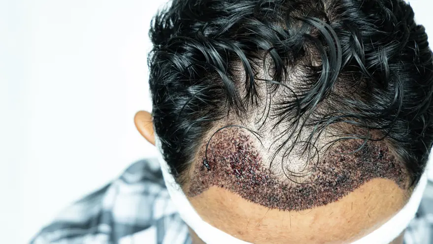 Hair renewal