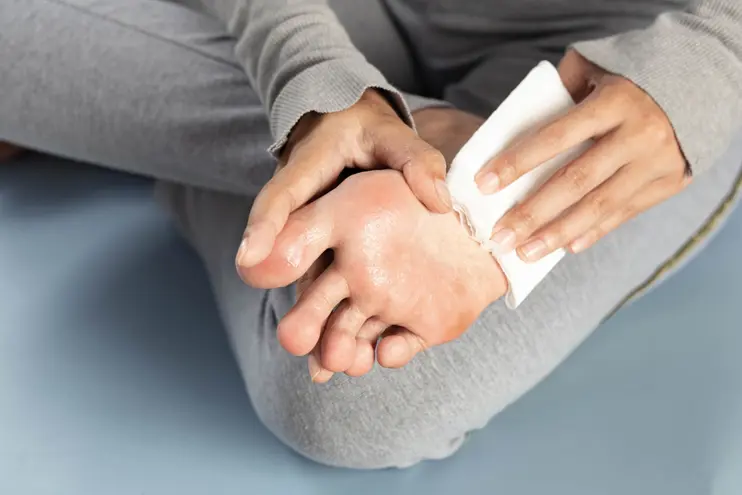 Types of Hyperhidrosis