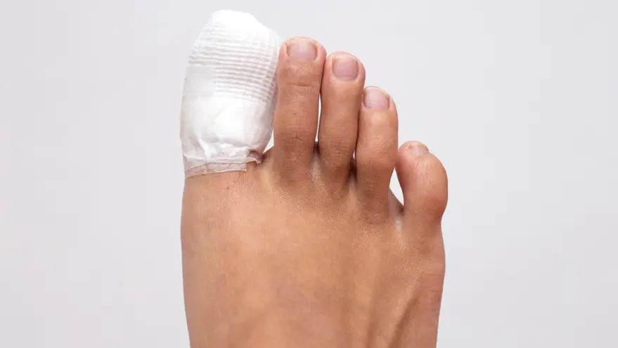 nail disorder